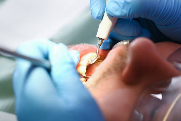 Best Emergency Tooth Extraction in Whitewater, KS